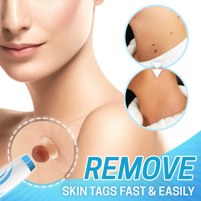 SkinBeauty™ Kit til fjernelse af mærker | I dag 50% rabat